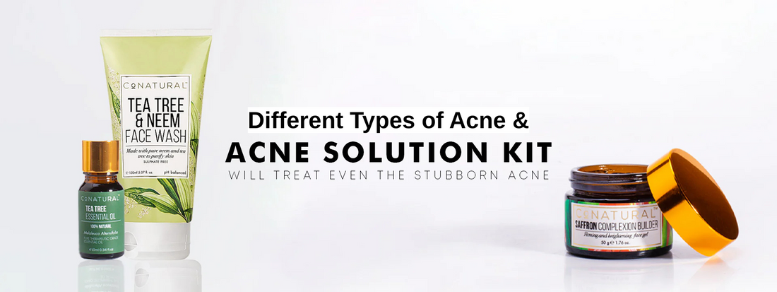 Different Types of Acne and Their Solutions