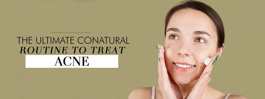 The Ultimate Conatural Routine to Treat Acne